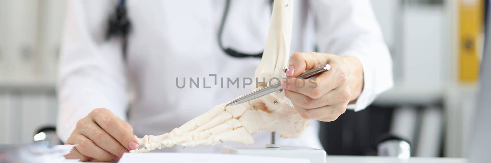 Orthopedic doctor explains physiology of bone model by pointing to point of model. Tell patient how to treat bone disease