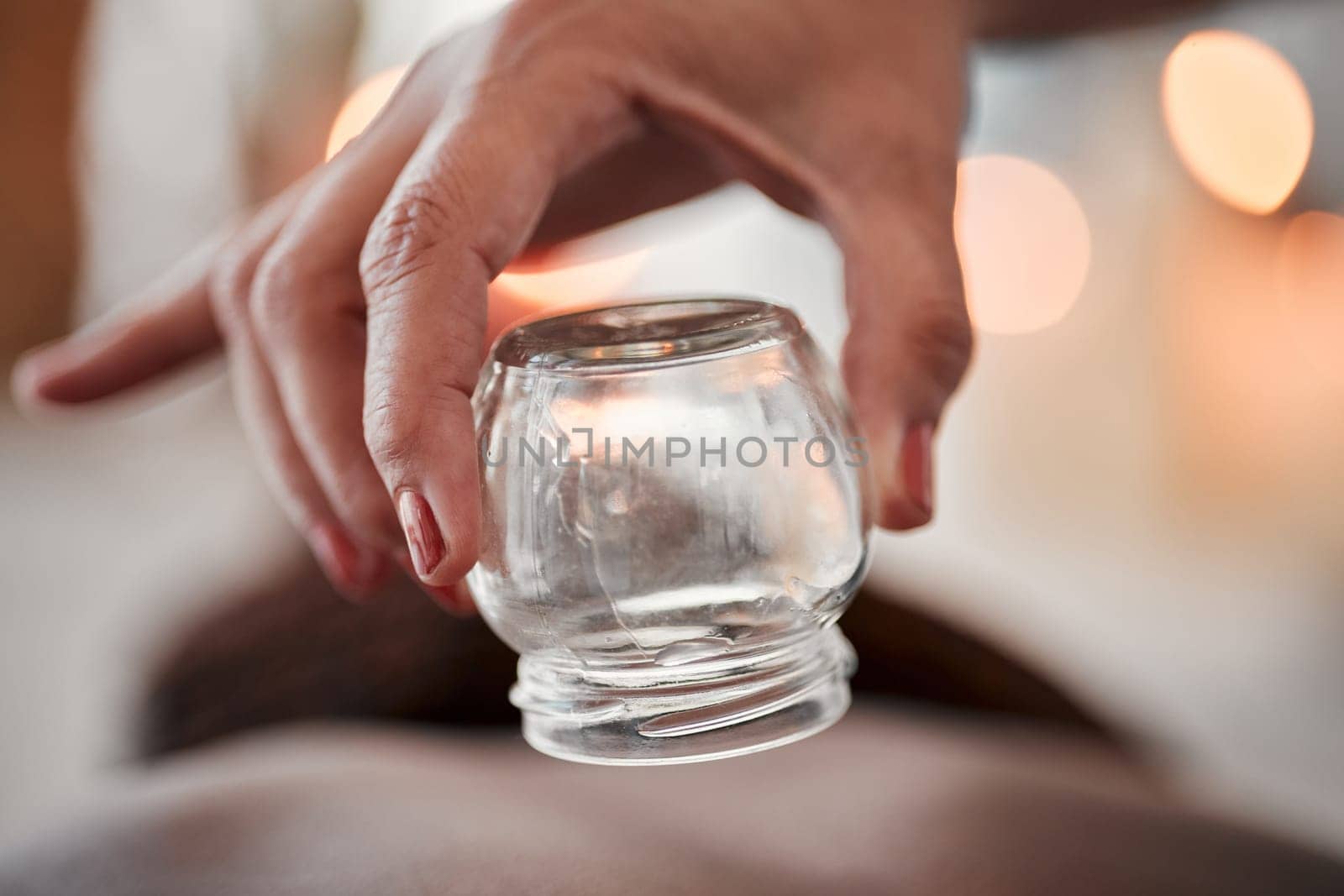 Cupping therapy, glass vacuum cup in hand and woman at spa, therapist with deep tissue massage and wellness. Closeup, treatment at luxury resort with cosmetic, body care and health with acupuncture by YuriArcurs