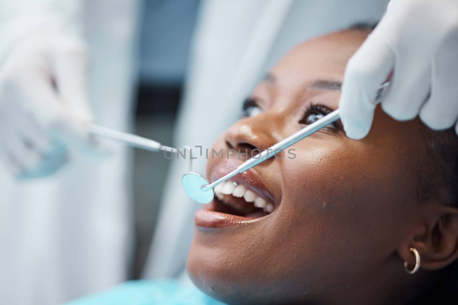 Black woman, mouth and face with dentist, tools in hands and dental, teeth check for healthcare with tooth decay. Tooth surgery, orthodontics and smile, teeth whitening, closeup and Invisalign by YuriArcurs