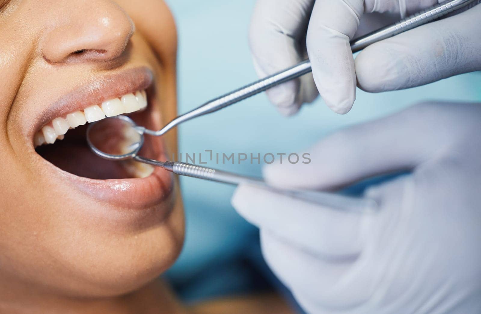 Dentist, healthcare and hands, patient mouth and medical tools, surgery and dental health. Tooth decay, orthodontics procedure and people in clinic for oral care, metal instrument and gingivitis.
