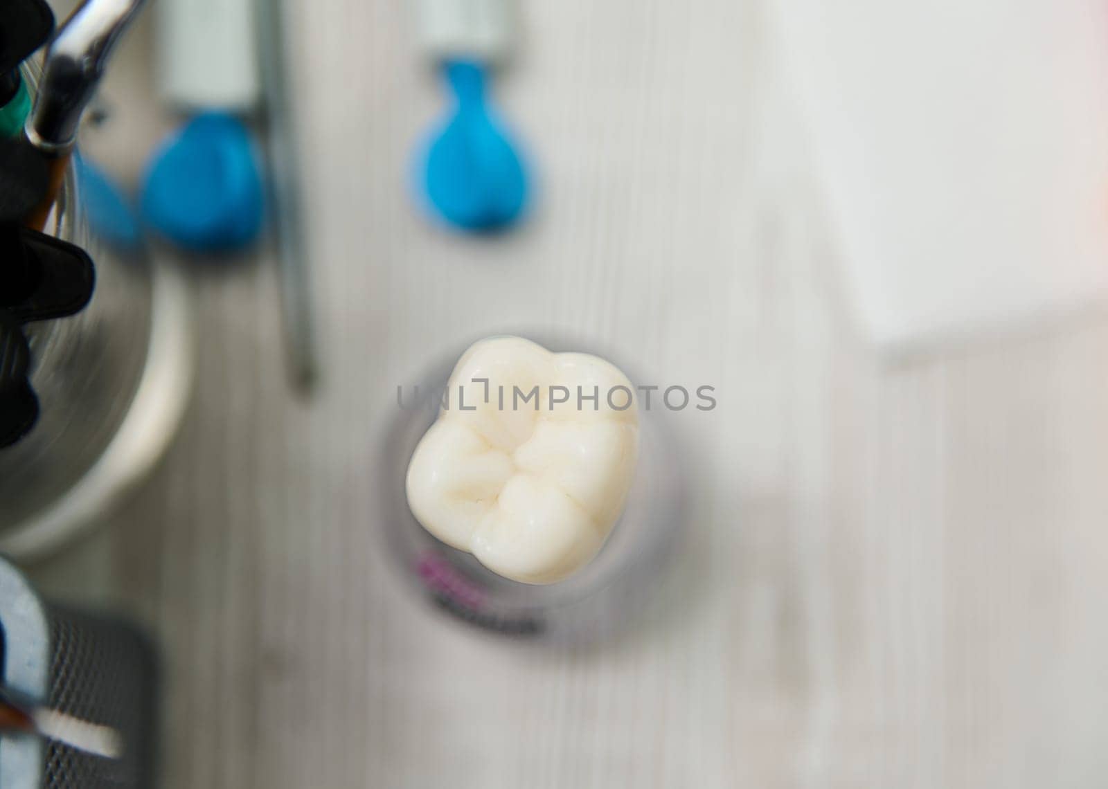 Top view ceramic model of enlarged human molar tooth on the dentist's worktop. Dental prosthesis installation concept by artgf