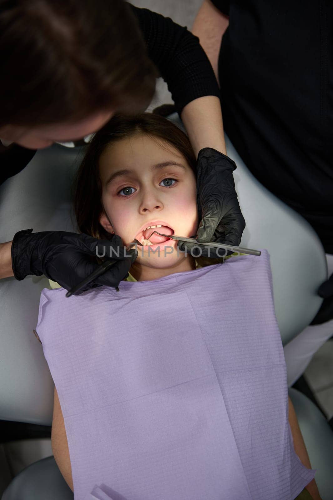 Treatment of baby teeth. Little girl with open mouth during dental preventive check up in pediatric dentistry clinic by artgf