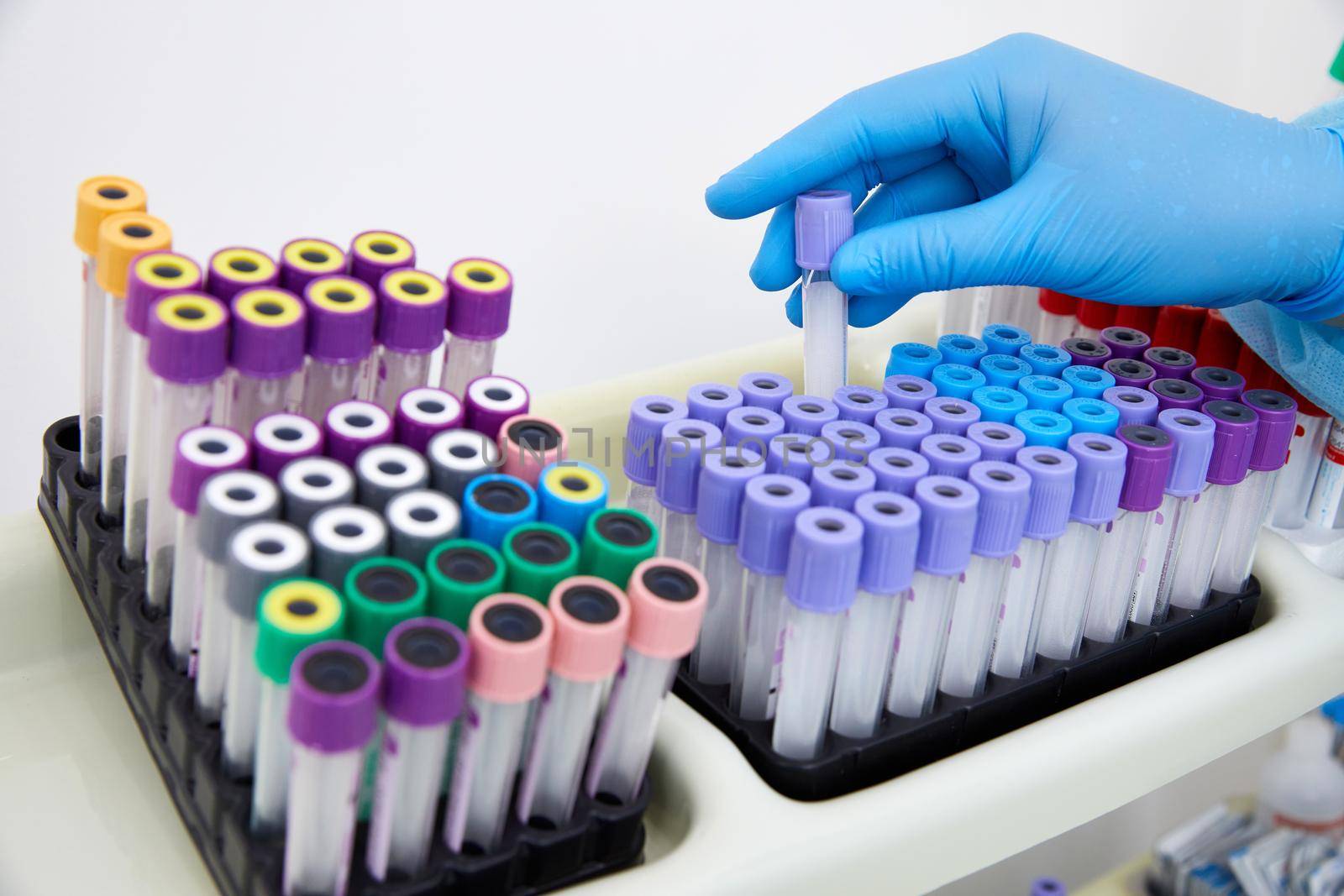 Scientist working with blood sample in laboratory. High quality photo