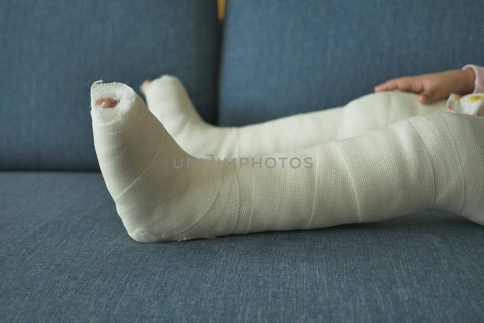 little child boy with plaster bandage on leg