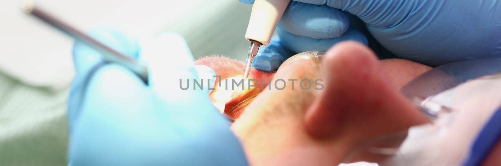 Dentist examines oral cavity of male patient with mirror. Services of dental clinics and dental treatment