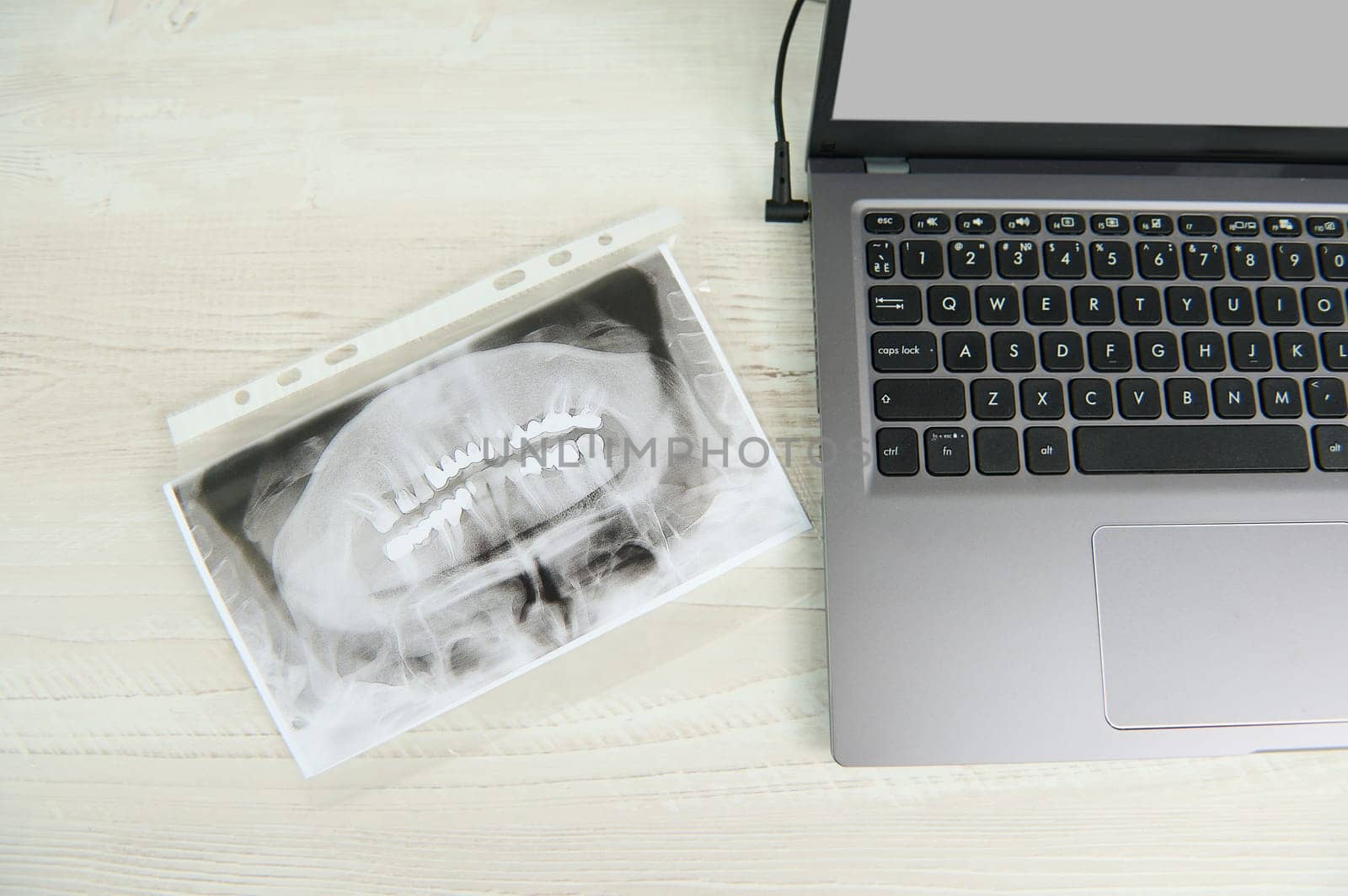 Orthopantomogram of human teeth, panoramic x-ray, next to a laptop with blank digital screen on dentist's desktop by artgf