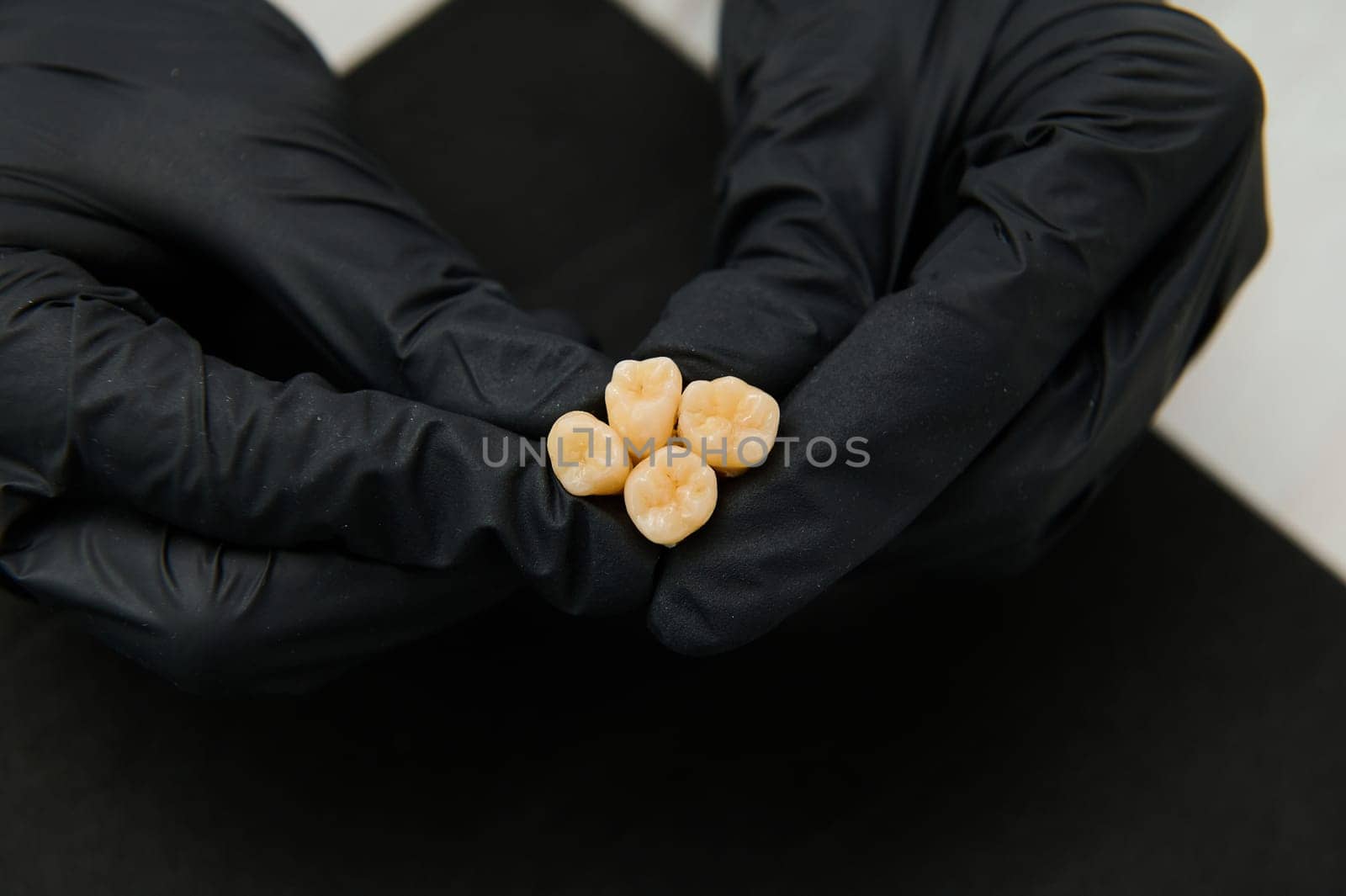 Top view of dentist's hands in black gloves hold the wisdom molars removed. Dental practice. Dentistry. Teeth treatment concept
