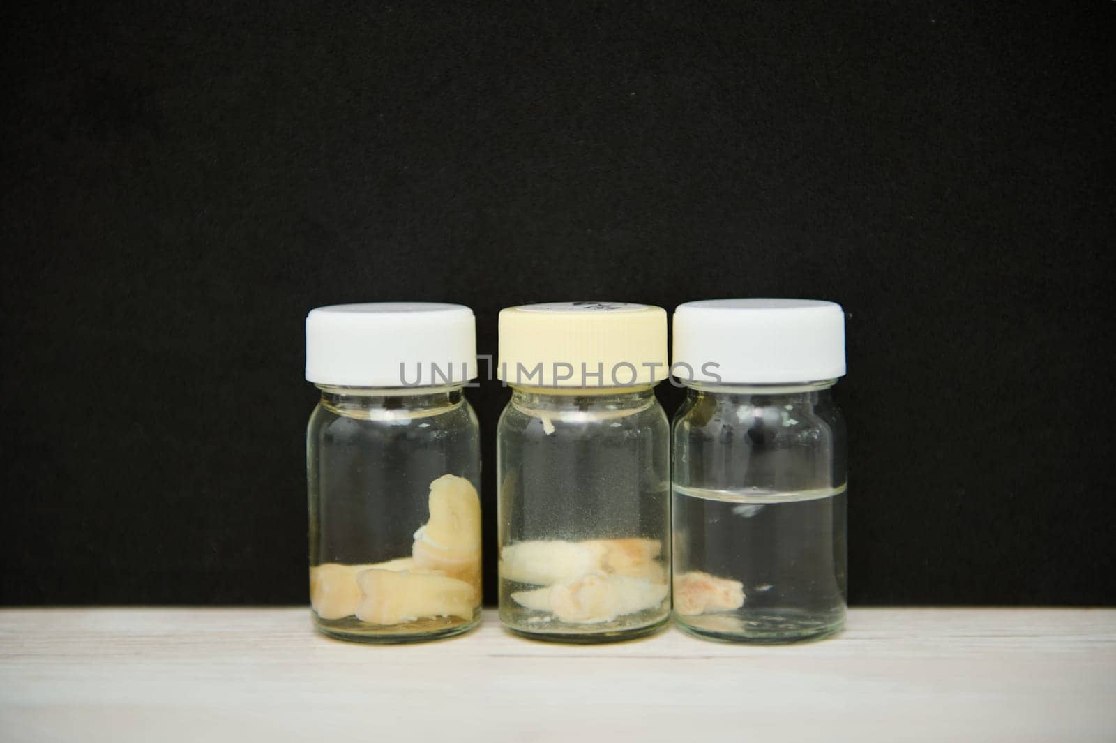 Medical bottles with wisdom molar teeth removed, on white surface on isolated black background. Maxillofacial surgery by artgf