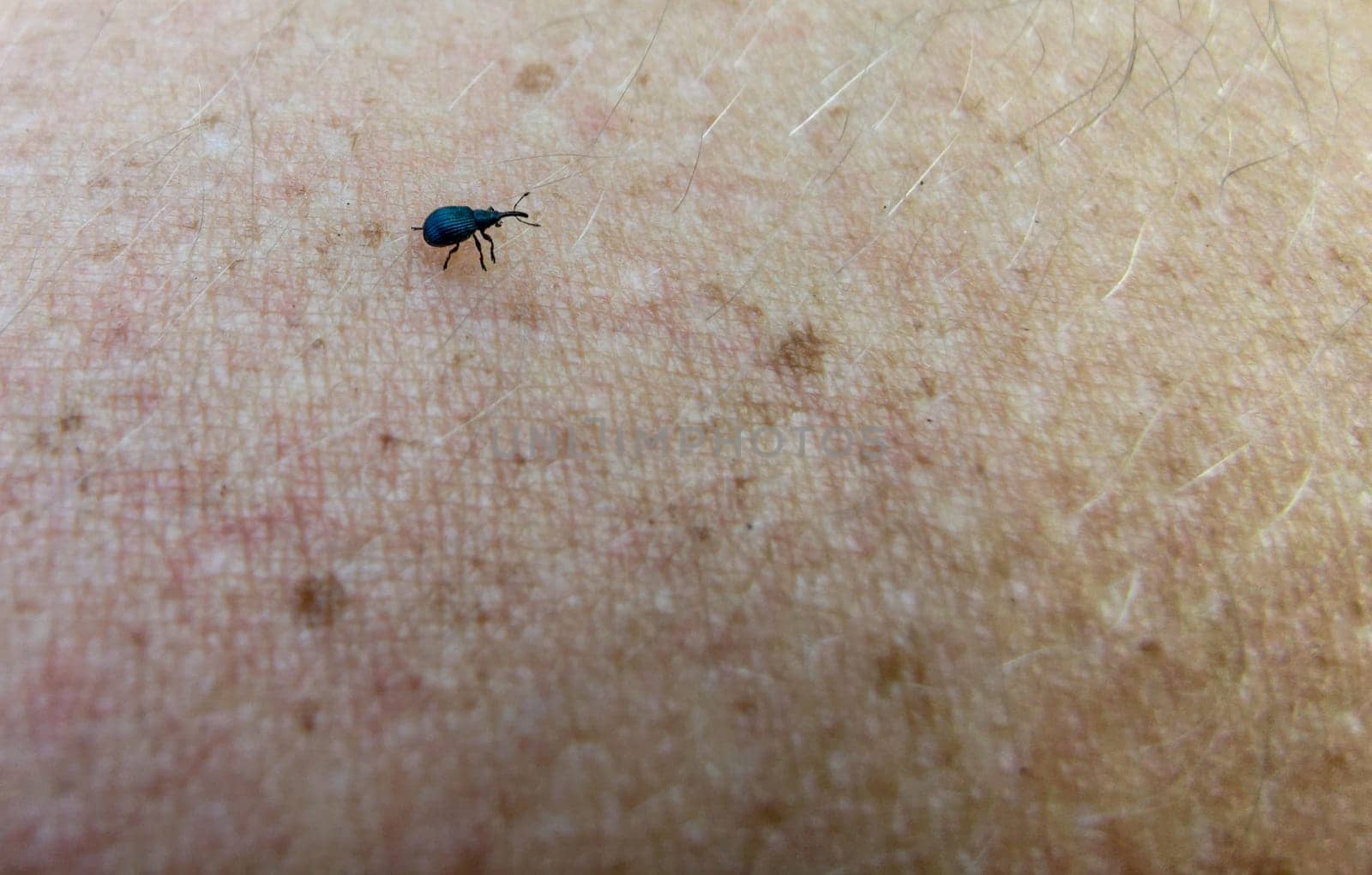 beetle on the human skin. parasite close-up. summer parasites