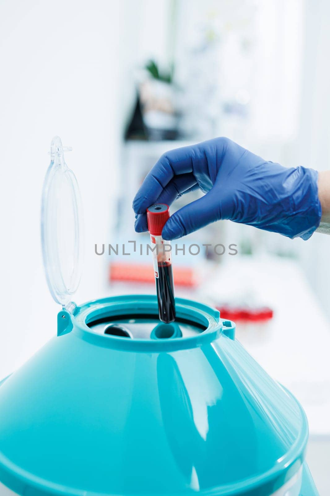 The blood in the test tube is placed in a centrifuge for plasma therapy. Modern medical equipment.