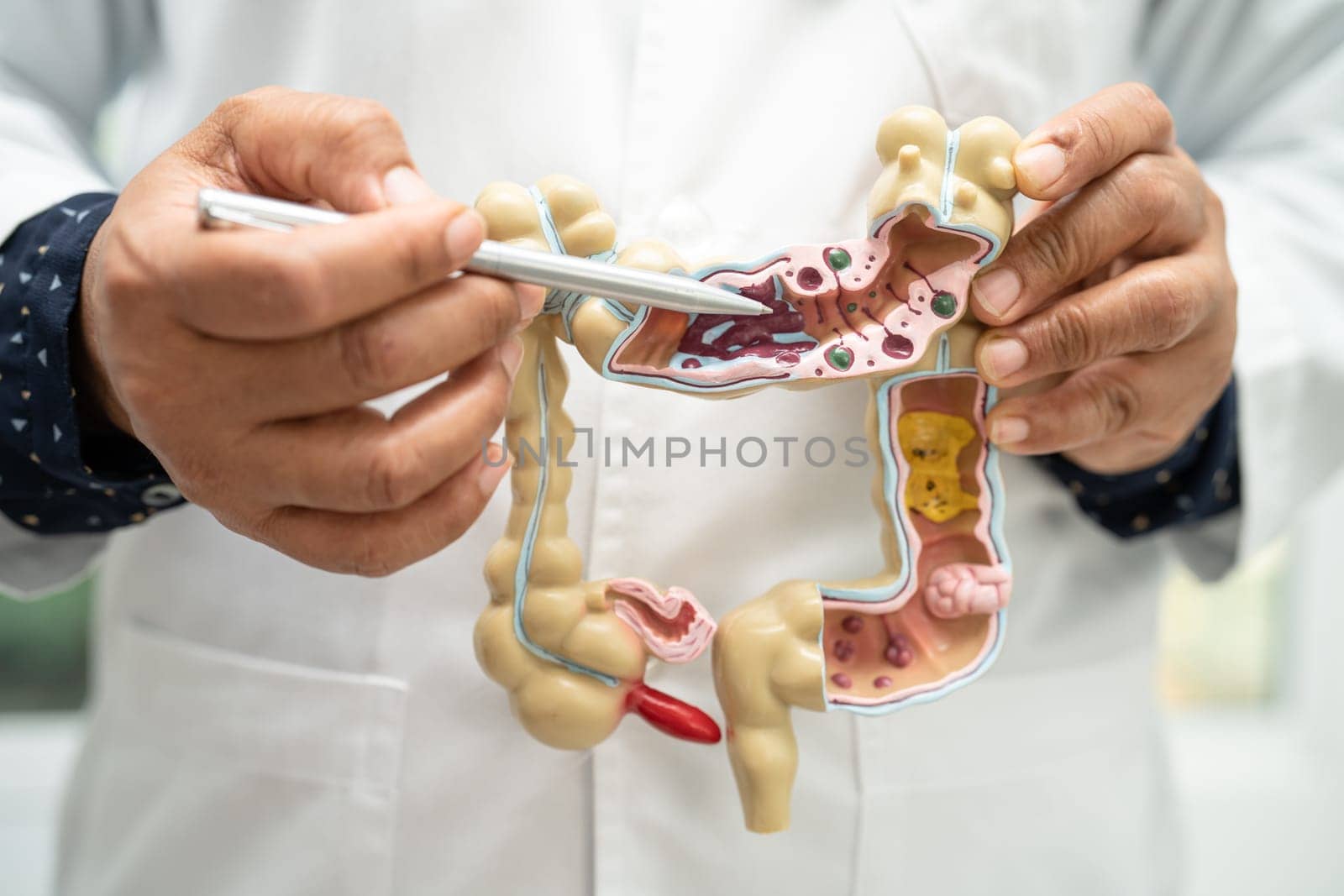 Intestine, appendix and digestive system, doctor holding anatomy model for study diagnosis and treatment in hospital. by pamai