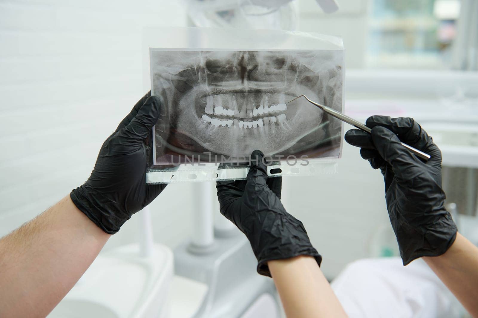 Close-up gloved hands of dentists holding panoramic X-ray image of human teeth, prescribing treatment in dental clinic by artgf