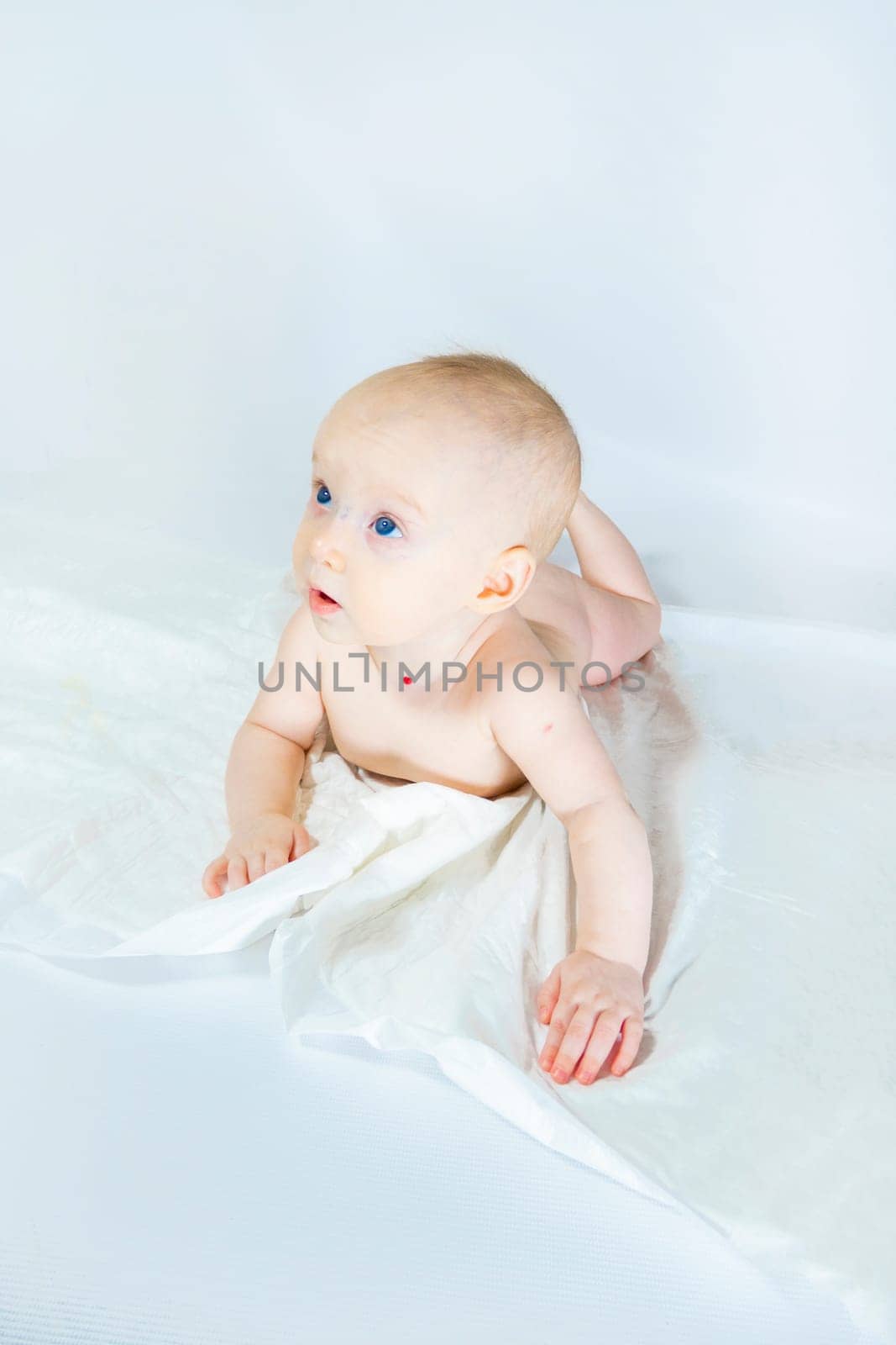 a baby with a hemangioma on his neck lies on a white background. banner with a copy space. profile of a little bald baby girl. the kid looks to the side