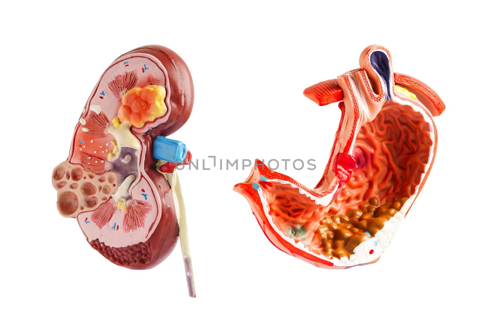 Kidney and stomach model isolated on white background. Chronic kidney disease, treatment urinary system, urology, Estimated glomerular filtration rate eGFR.