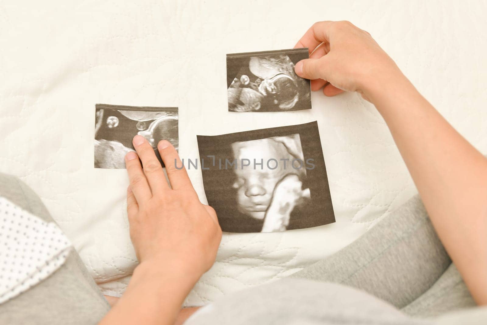 Pregnant woman holding 4D ultrasound image