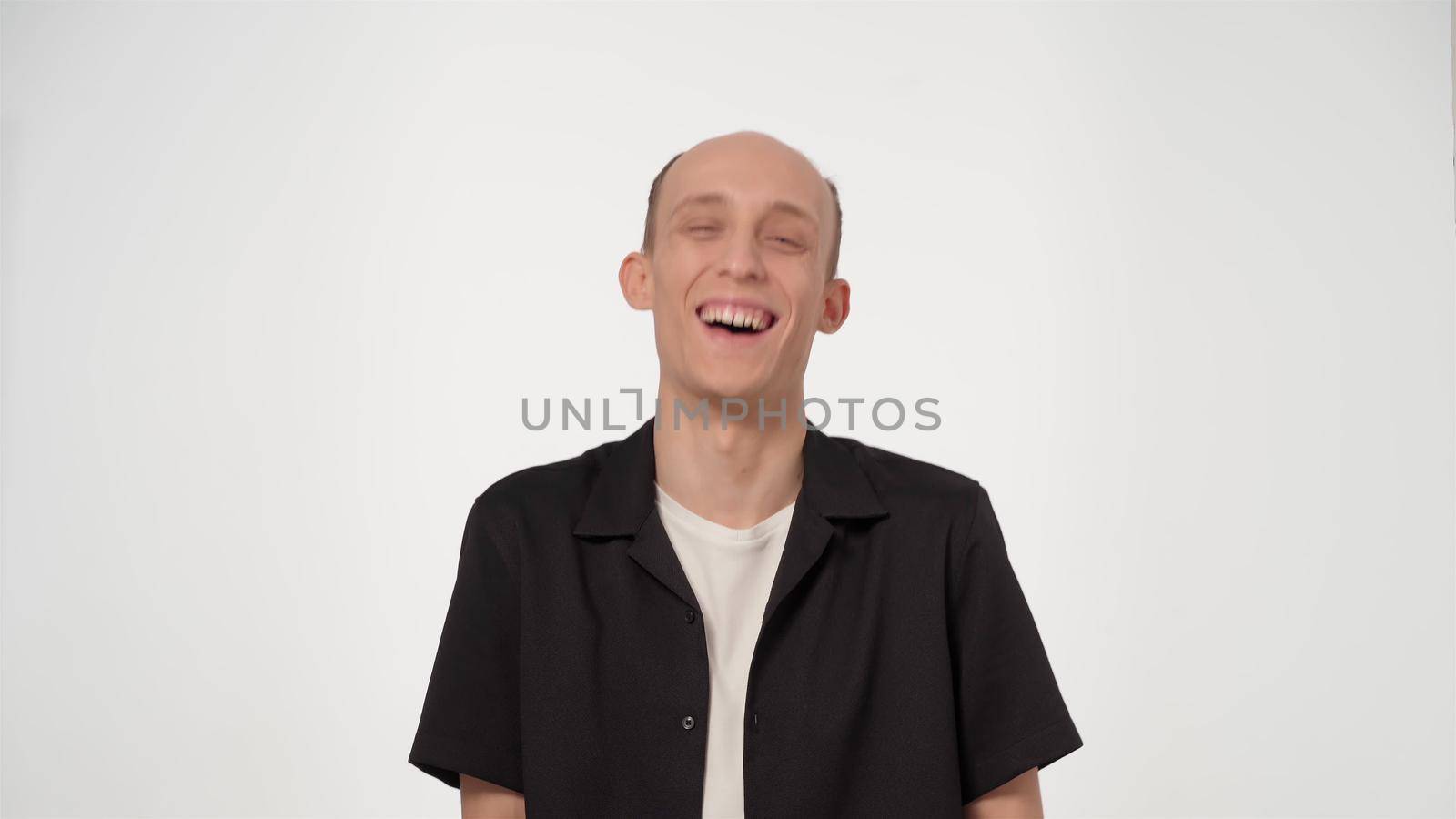 laughing hard handsome man with hair loss and baldness looking at camera wearing black shirt isolated on white background. Hair treatment and transplantation. Hair loss. 4K video.