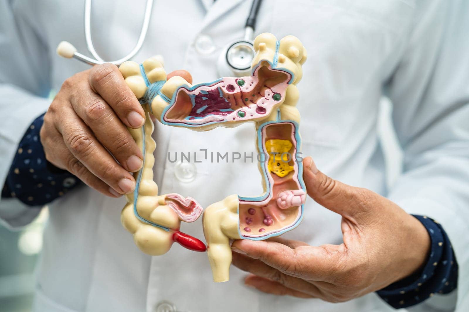 Intestine, appendix and digestive system, doctor holding anatomy model for study diagnosis and treatment in hospital. by pamai