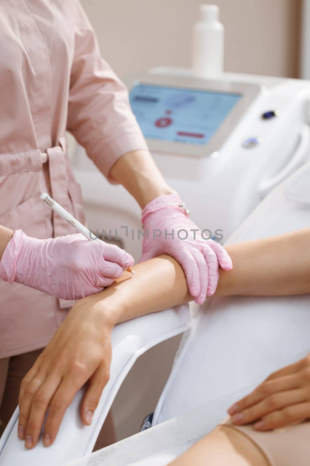 Laser hair removal specialist draws on moles on the woman's hand with a protective pencil. Women's hands in gloves mark the area for epilation and protection of moles with a pencil.