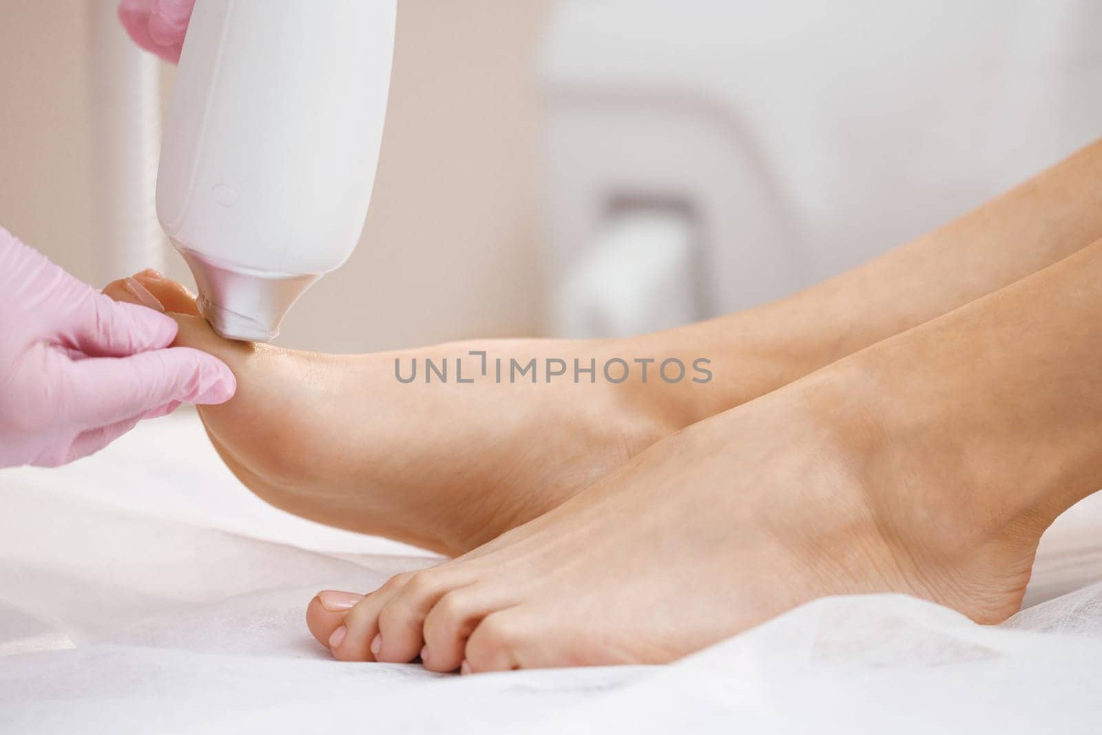 The doctor makes the procedure for the treatment of foot fungus. Patient receiving laser therapy for a toenail. Fungal infection on the nails. Treatment of onychomycosis with a medical laser by uflypro