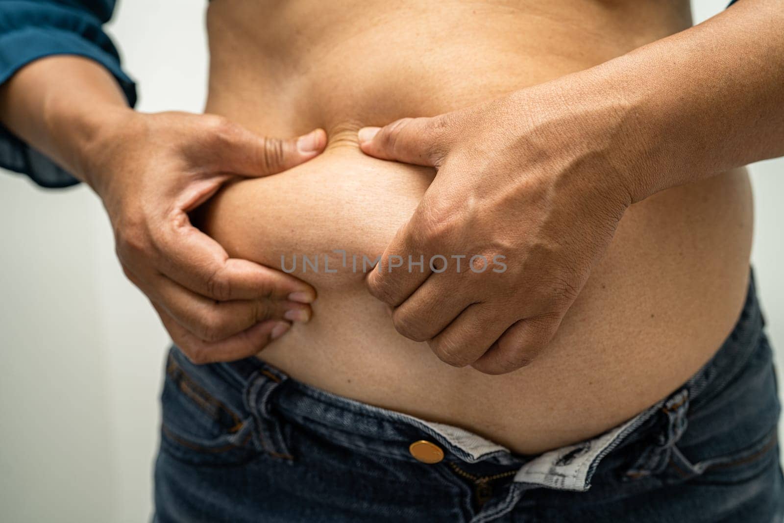 Overweight Asian woman show and use hand to squeeze fat belly. by pamai