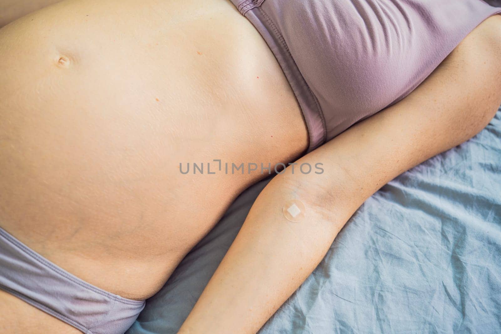 Adhesive bandage on arm after blood test from pregnant woman in gynecological clinic. Prenatal testing. Medical Equipment, Adhesive bandage on a female brachium in medical clinic. Close up, Top view.