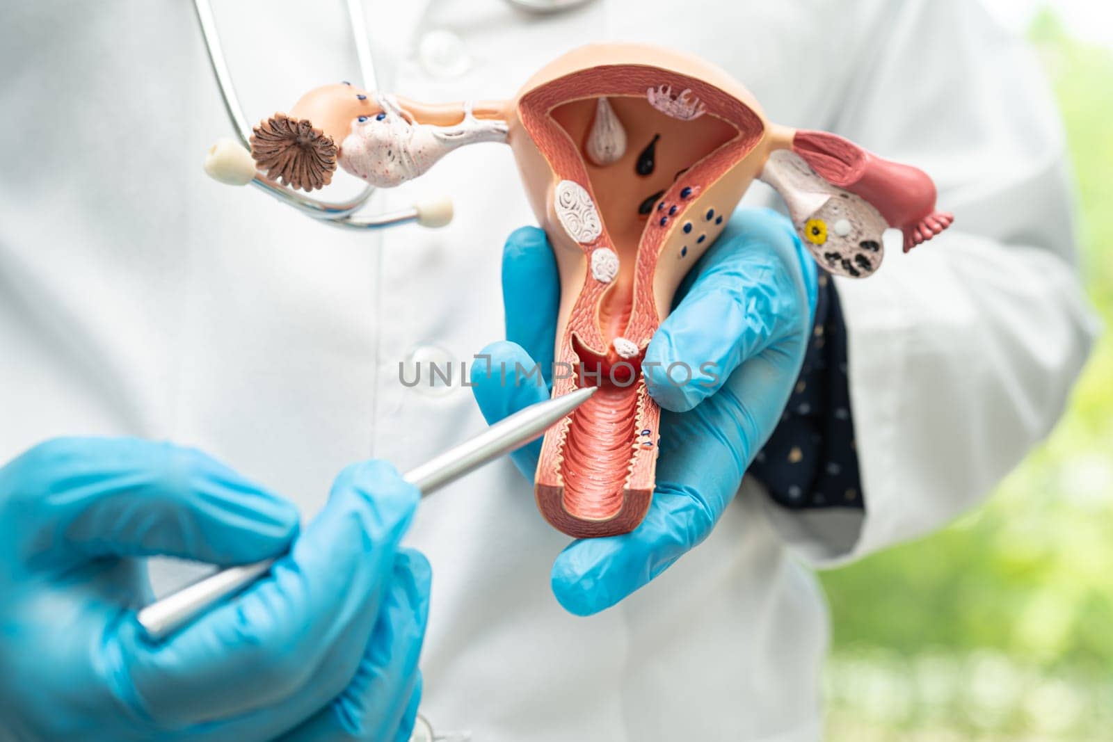 Uterus, doctor holding anatomy model for study diagnosis and treatment in hospital.