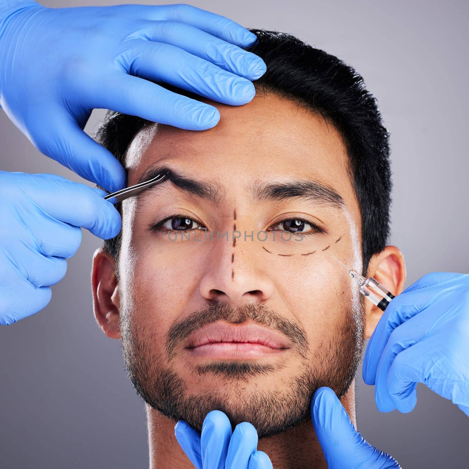 Plastic surgery, brow lift and drawing with portrait of man and surgeon for needle and syringe placement. Hands, face and dermatology of a male person with medical procedure and collagen in studio by YuriArcurs