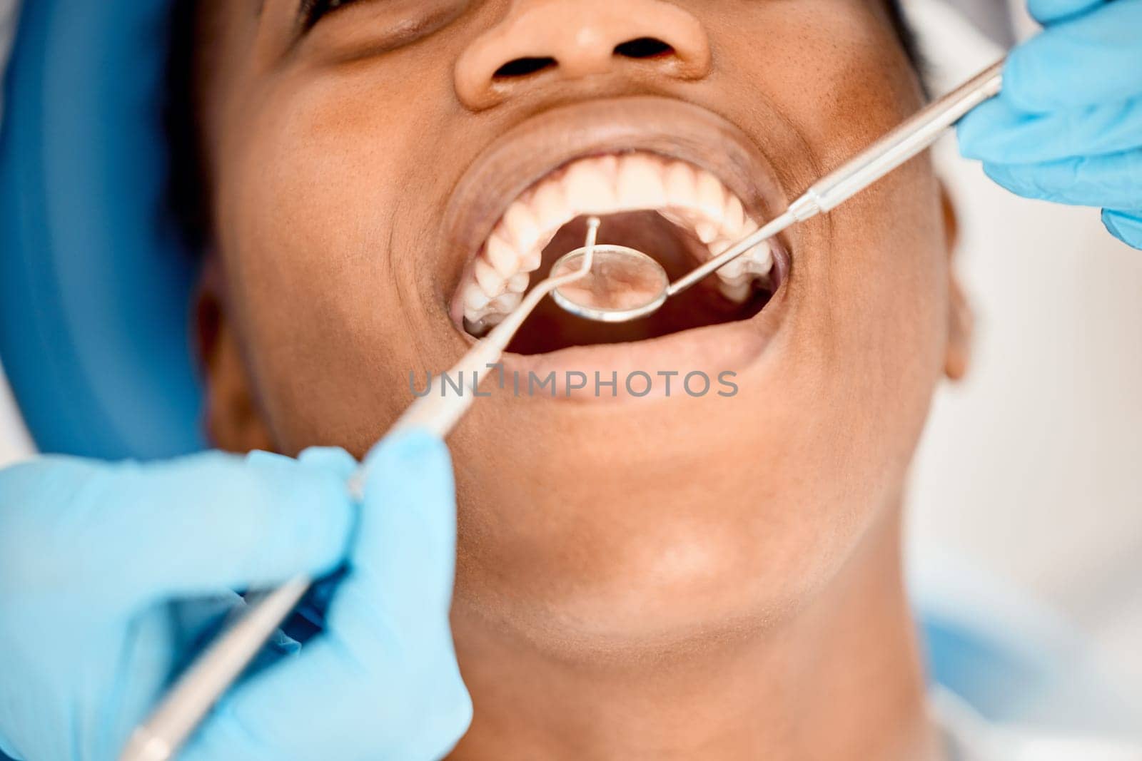Dentist, black woman mouth and patient at a clinic with medical and healthcare for teeth cleaning. Mirror, orthodontist and African female person with wellness and dental work tool with care.