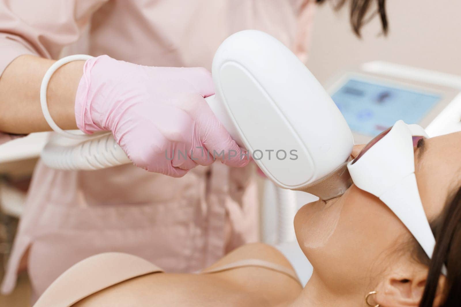 Elos epilation hair removal procedure on the face of a woman. Beautician doing laser rejuvenation in a beauty salon. Facial skin care. Hardware ipl cosmetology. Laser mustache hair removal by uflypro