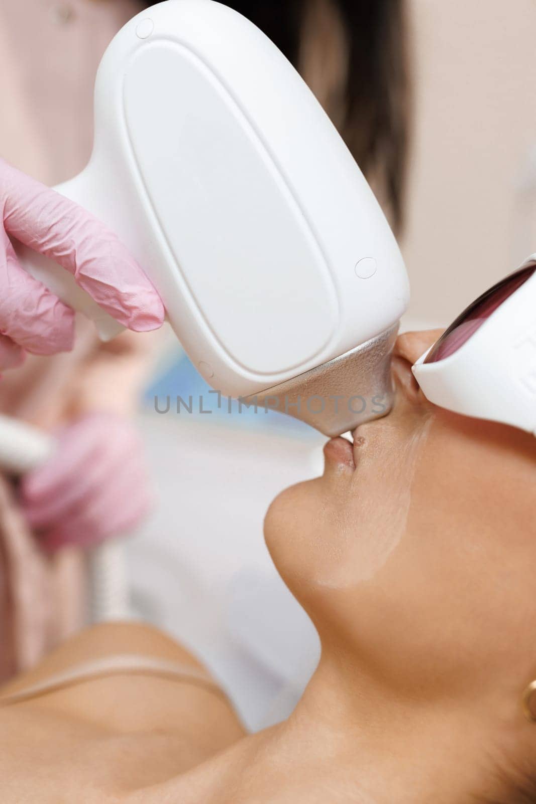 Pretty brunette woman getting hair removing on face. Procedure laser epilation at beauty studio. Hair removal over lips. Woman during a laser hair removal procedure and female mustache removal. by uflypro