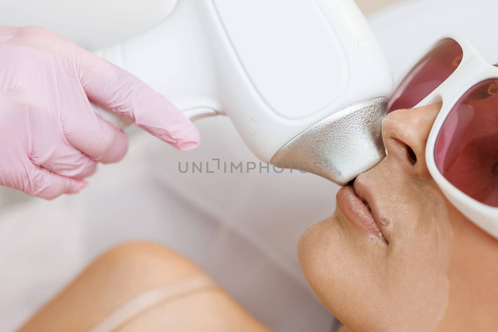 The cosmetologist does the procedure for laser hair removal of unwanted hair of the face to a young girl in a beauty salon. Dermatology, photorejuvenation. Cosmetic clinic. by uflypro