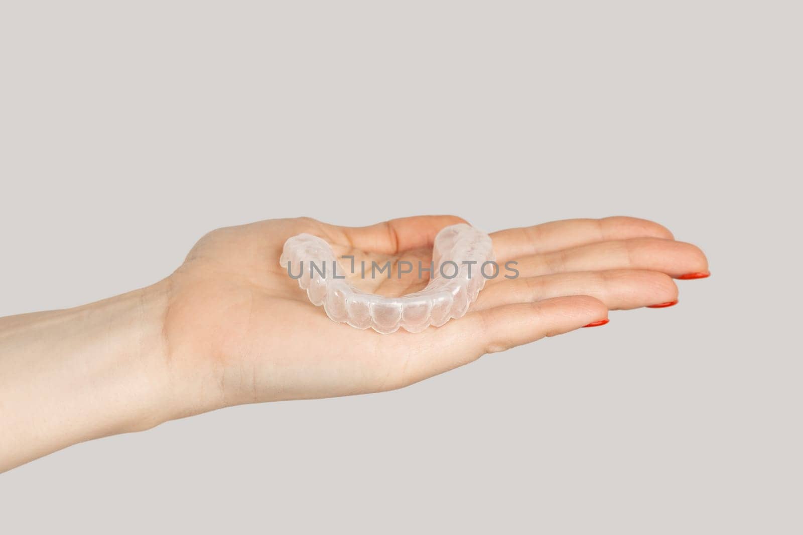 Woman hand showing invisible orthodontics cosmetic aligners. by Khosro1