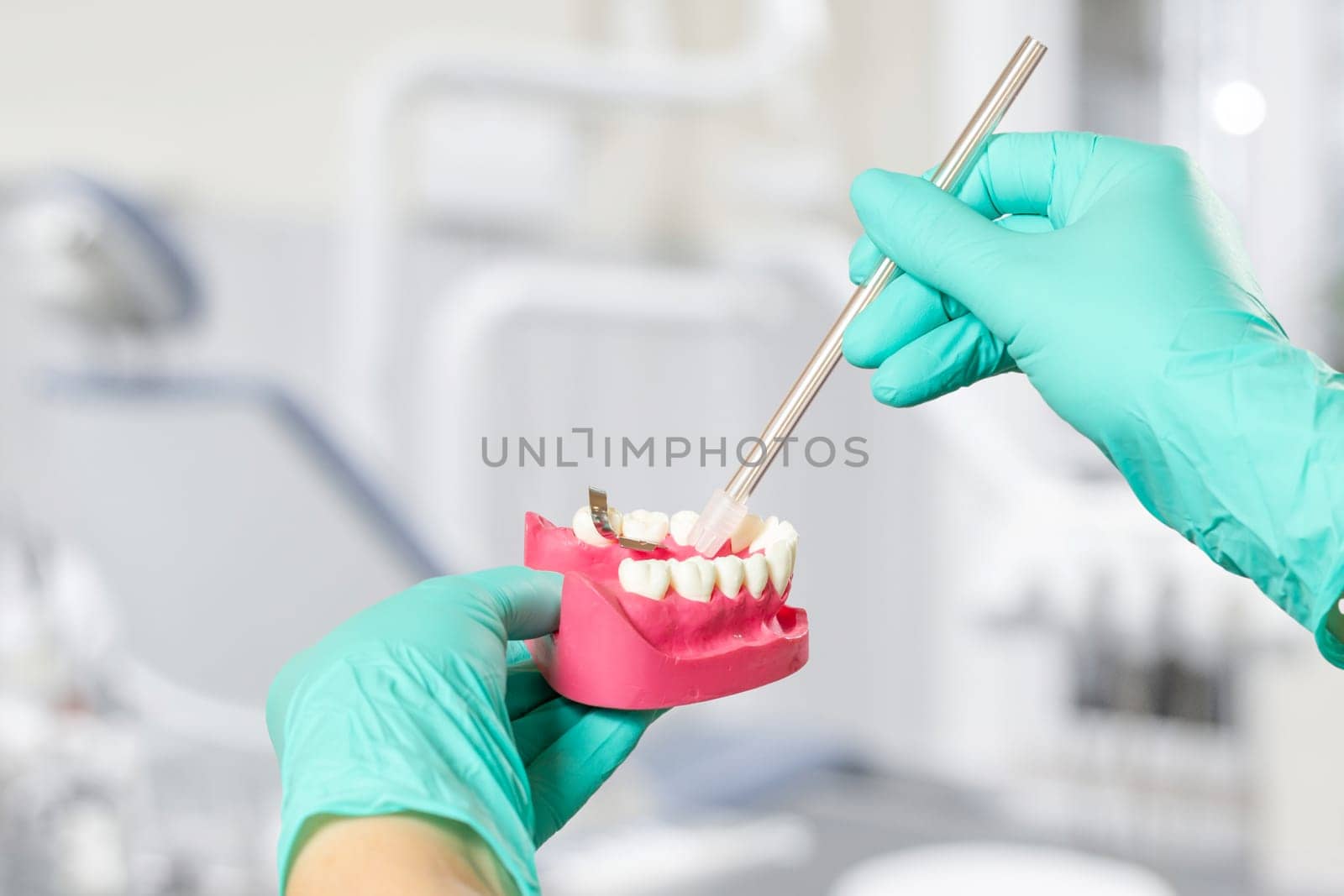 Dentist's hands in gloves with a saliva ejector and a human jaw layout. by mvg6894