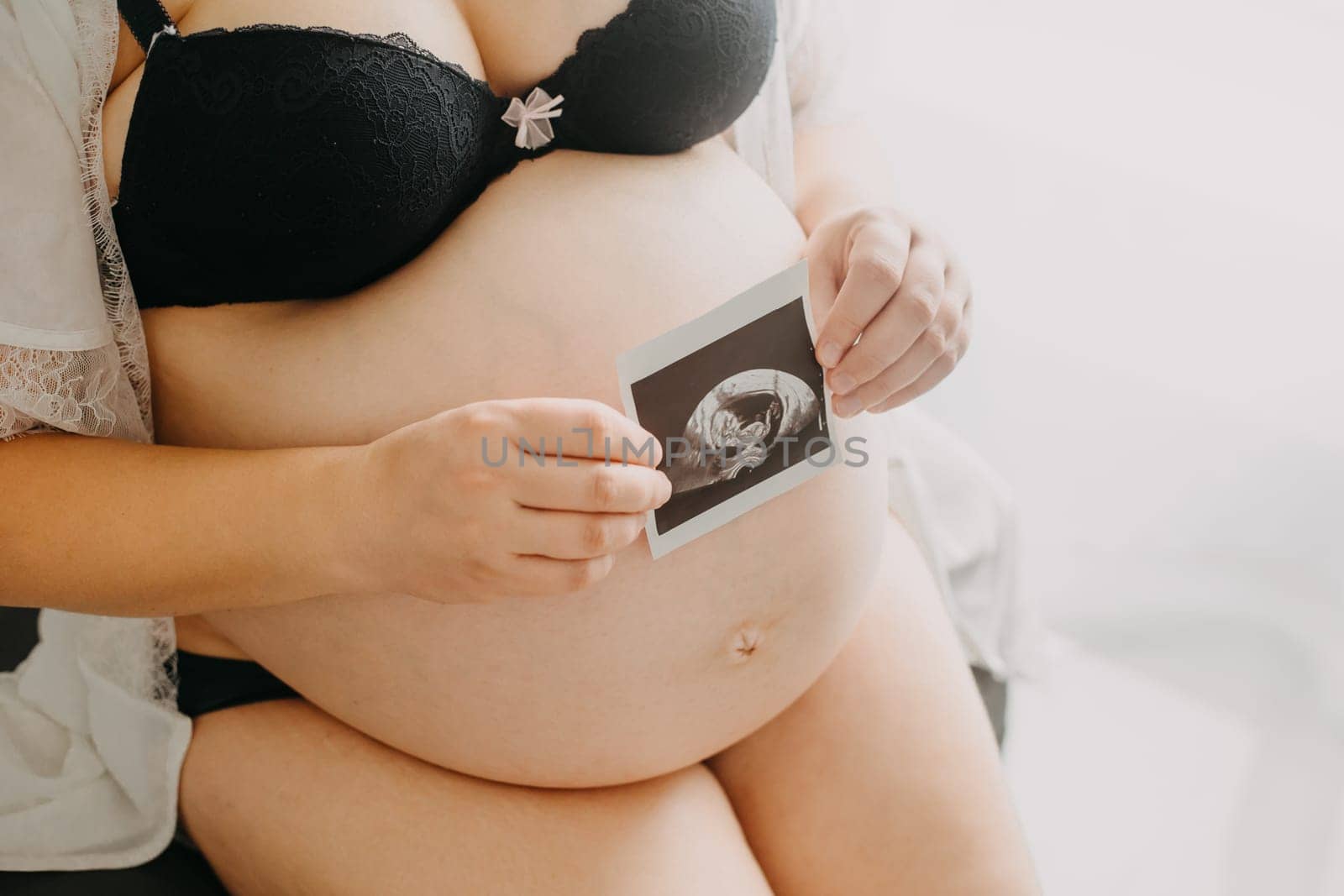 Young pregnant woman with the belly and babys ultrasound paper in the hand, pregnancy concept