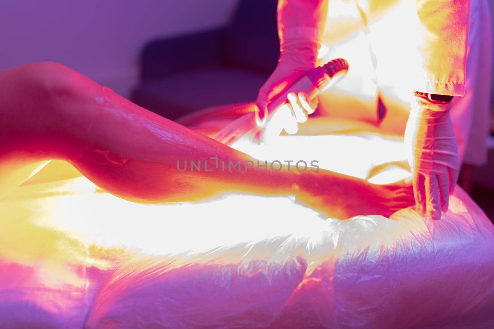 Laser hair removal and cosmetology. Cosmetic hair removal procedure. bright laser flash creative colorful shot.