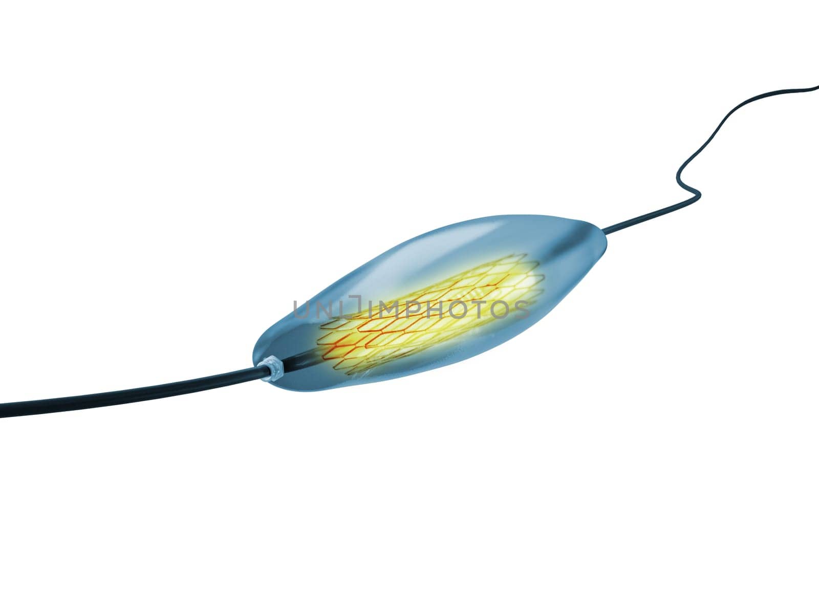 mesh metal nitinol self-expandable stent 3D rendering for endovascular surgery isolated on white background. Clipping path. by samunella