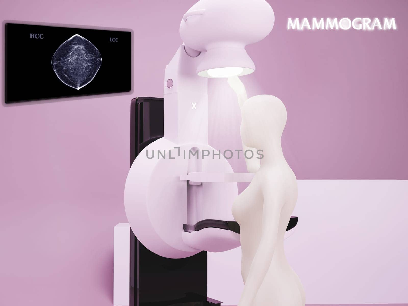 Mammography device  for screening breast cancer in Hospital  with 3D woman model .3D rendering .