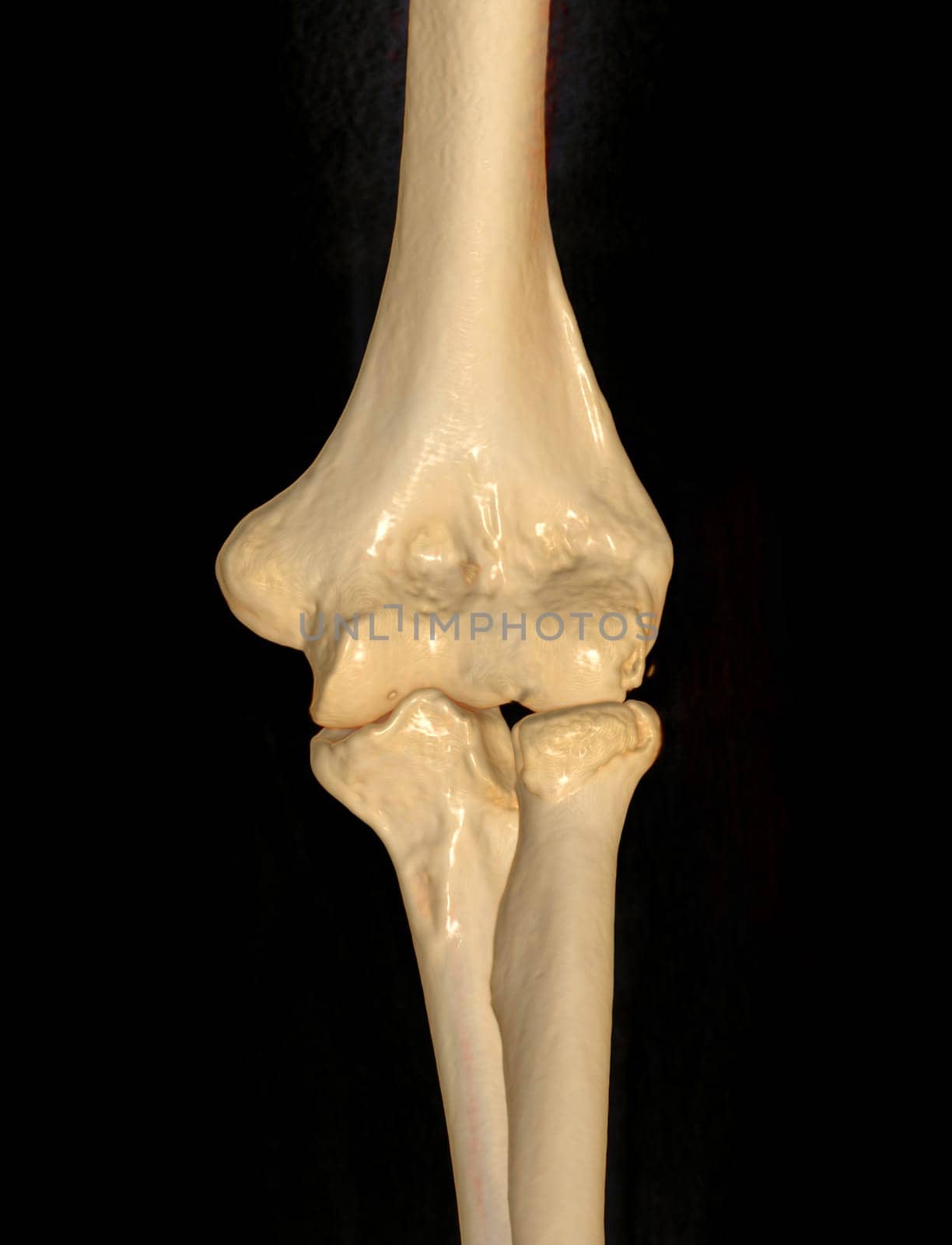 CT scan of elbow joint 3d rendering . by samunella