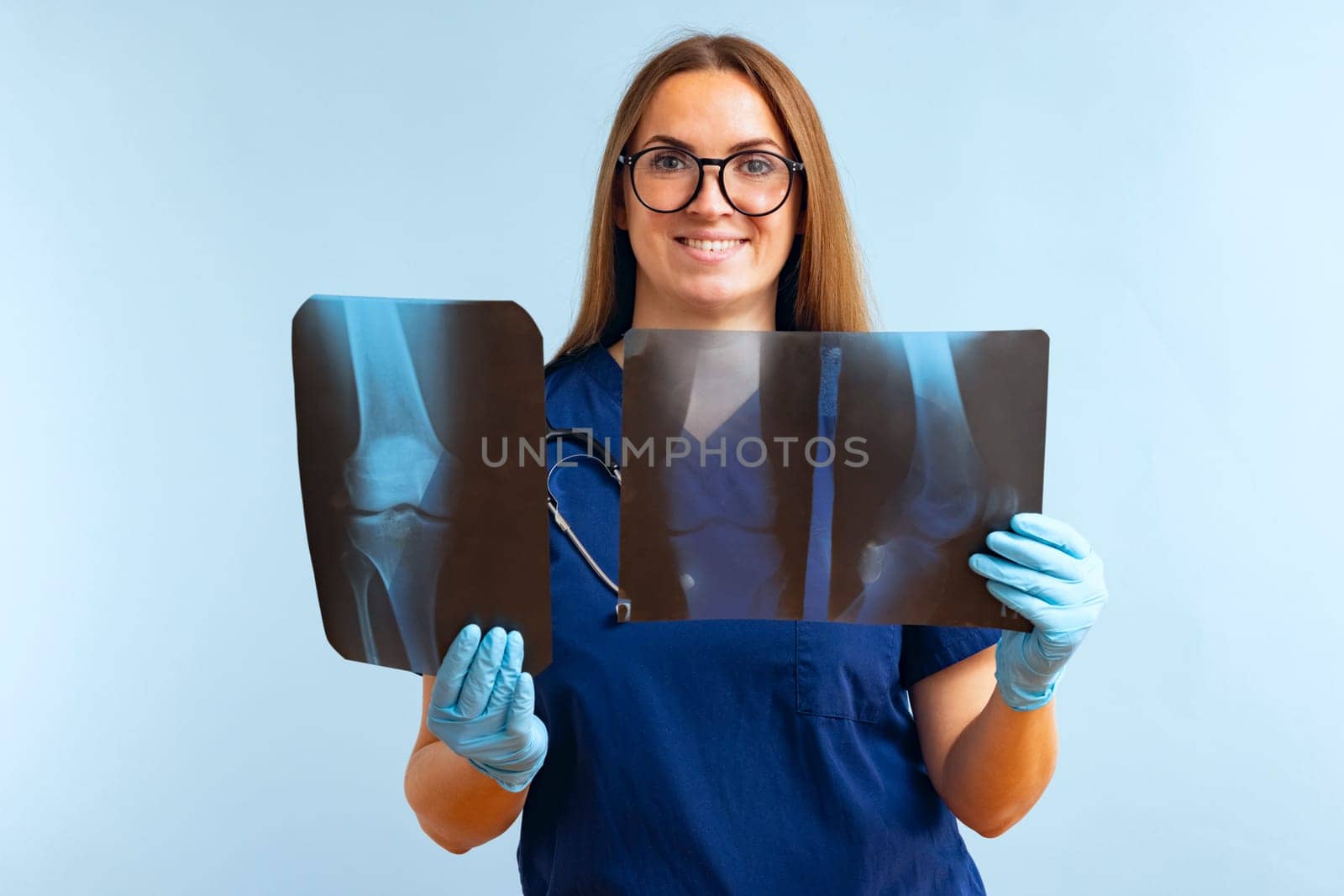 Woman doctor analyzes x-ray images of the patients injured leg on a blue background.