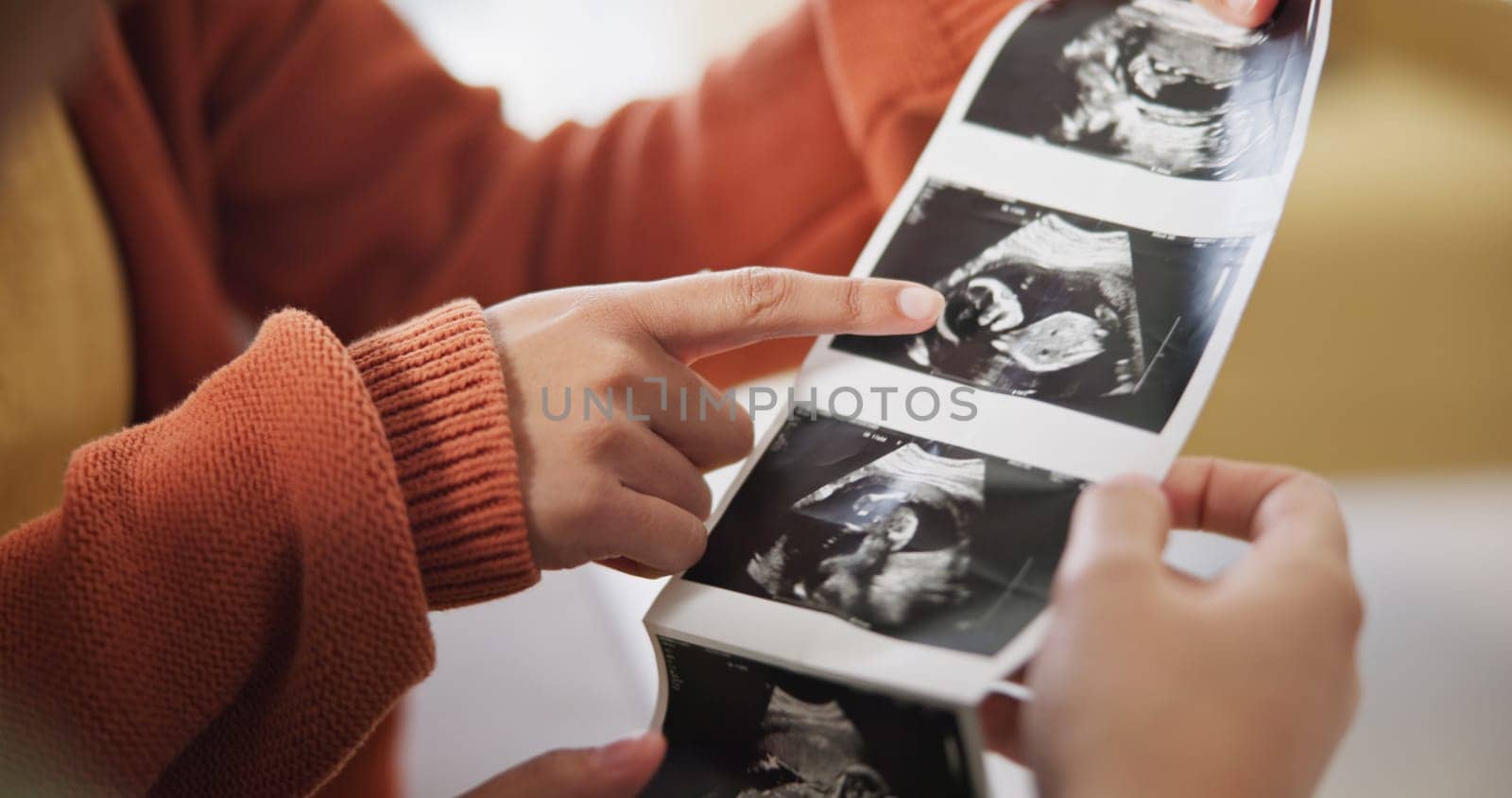 Ultrasound, surprise and ivf pregnancy with a gay couple in the living room of their home together for celebration. Wow, LGBT or lesbian with a woman and partner hugging while looking at a picture.