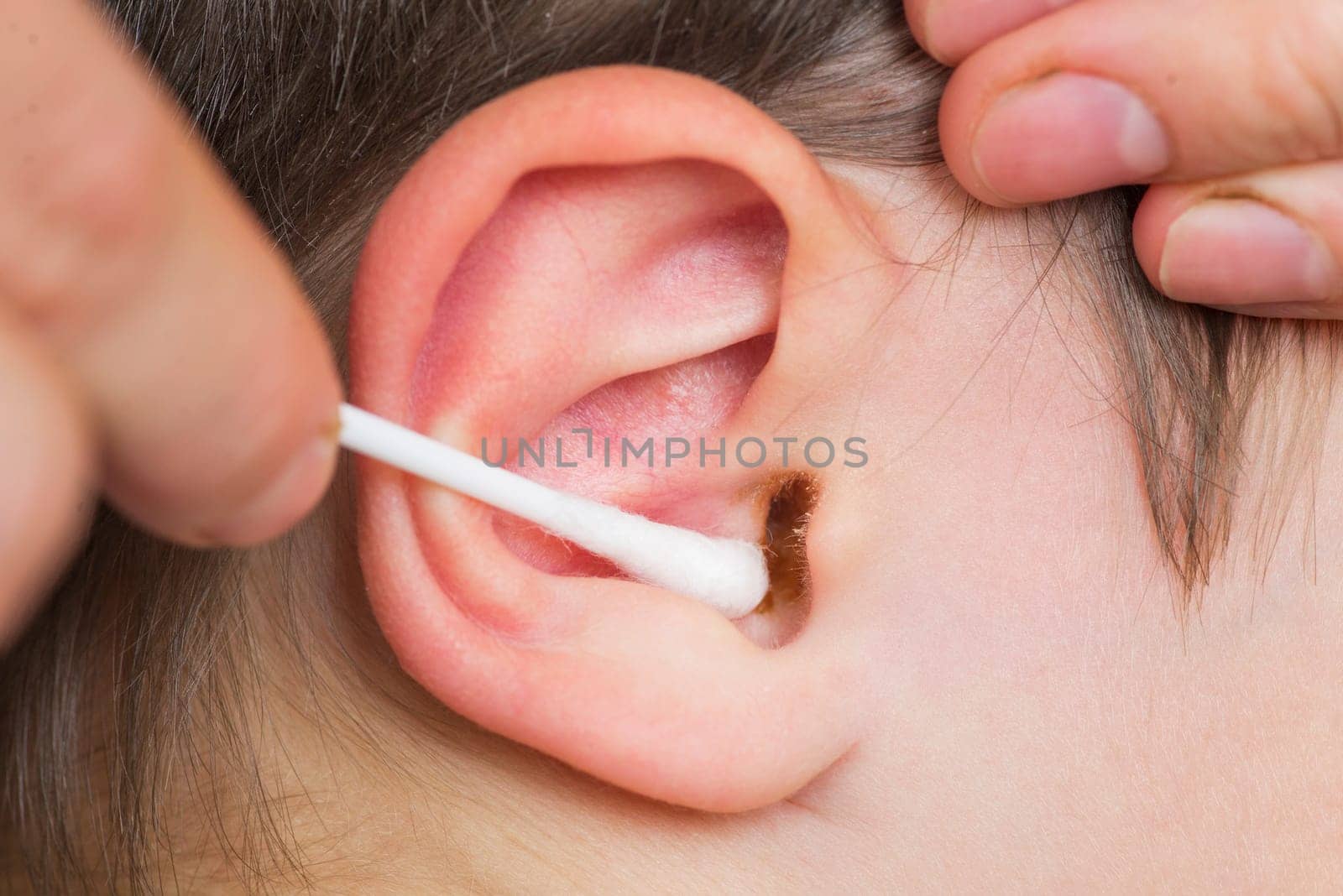 Mothers hand cleaning baby ear with cotton swab. Closeup of mothers hands are cleaning childs ear with cotton swab.