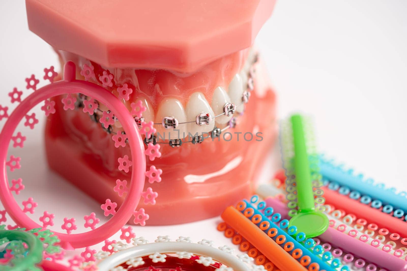 Orthodontic ligatures rings and ties, elastic rubber bands on orthodontic braces, model for dentist studying about dentistry.