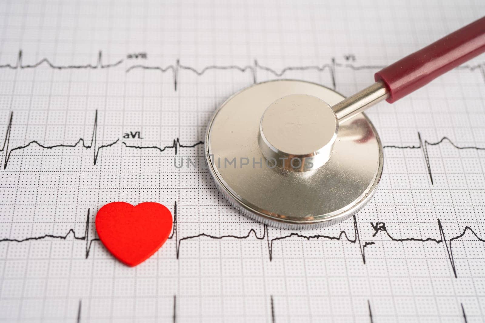 Stethoscope on electrocardiogram ECG, heart wave, heart attack, cardiogram report. by pamai