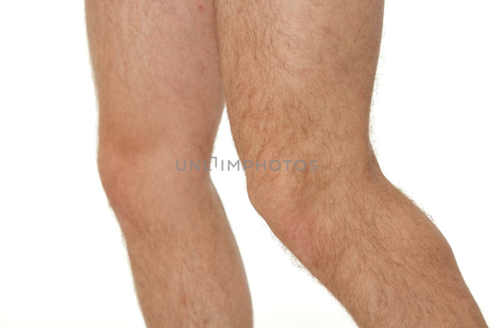 male legs close up on white background by erstudio
