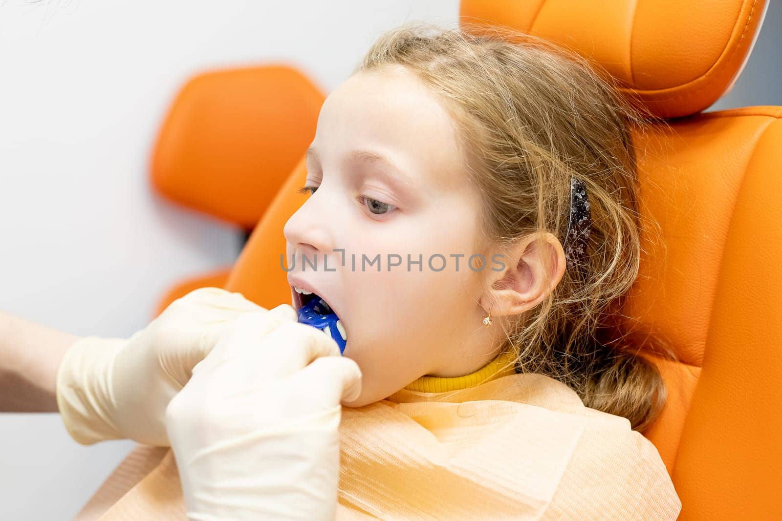 The orthodontist prepares a special paste for making an impression of the patient's teeth.Child during orthodontist visit and oral cavity check-up by YuliaYaspe1979