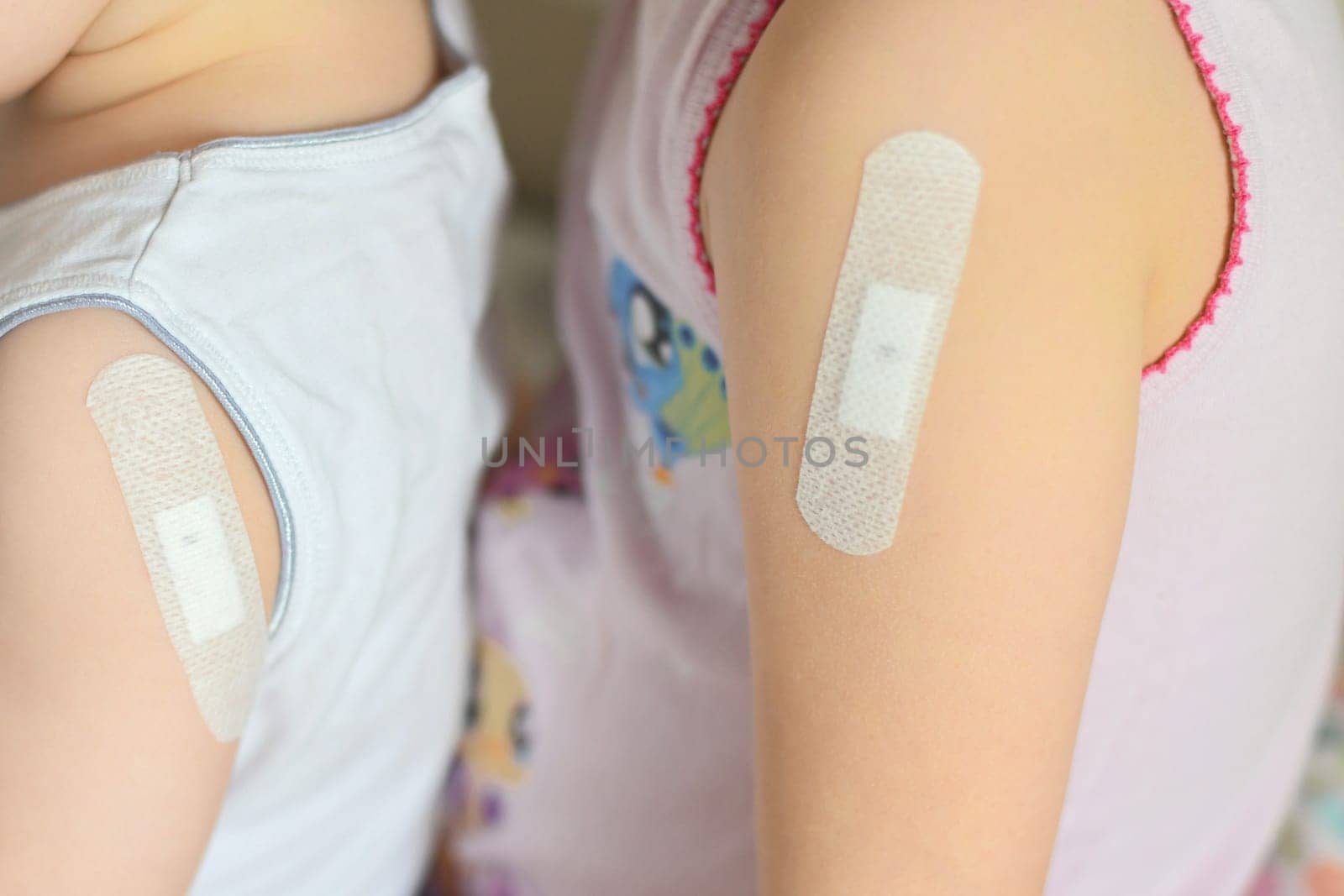 Brother and sister with patch on forearm after tuberculosis vaccine bcg