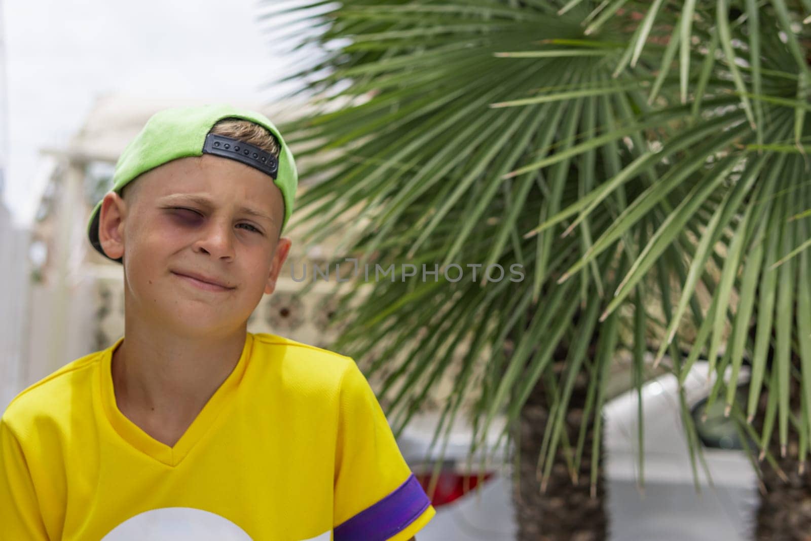 a boy with a black eye sits in the park, portrait of a boy in a cap with a black eye by PopOff