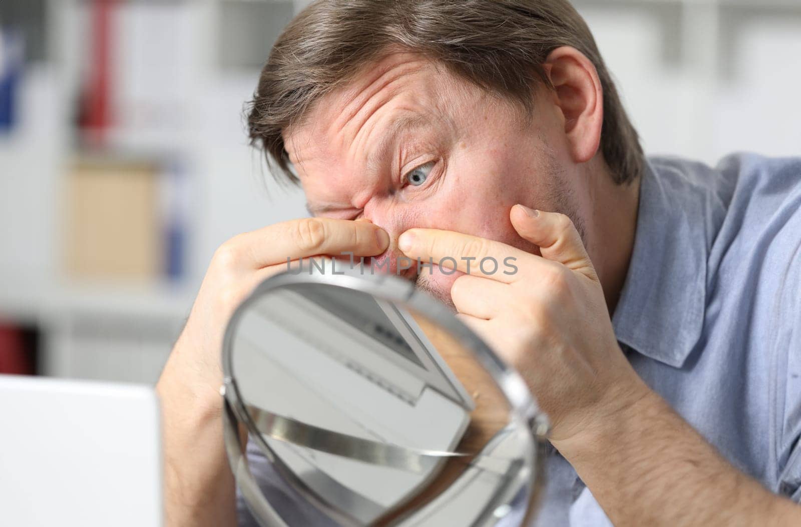 Young attractive man sits in front of a mirror and crushes acne. Healthy facial skin concept