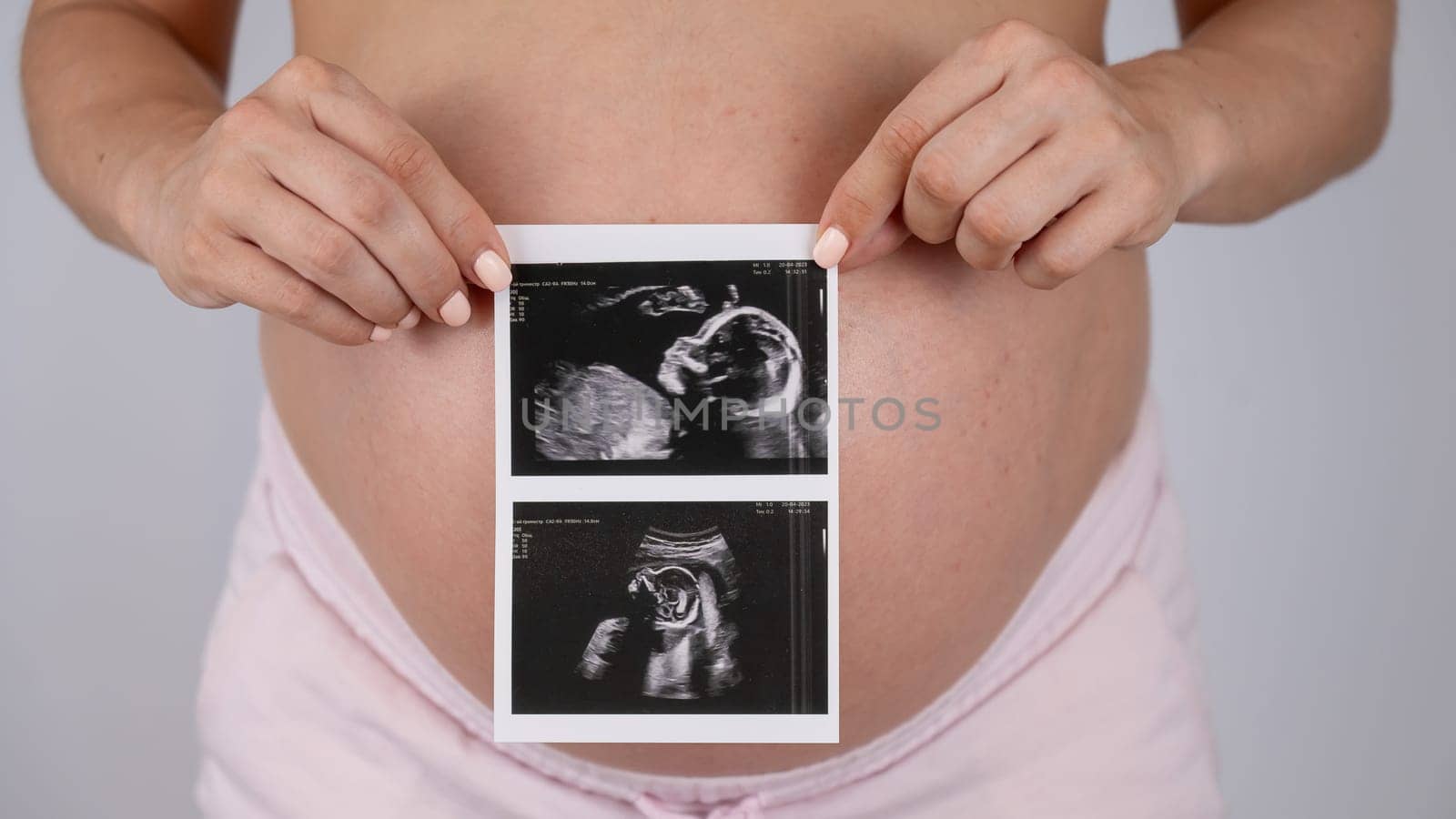 A pregnant woman holds a photo from an ultrasound screening against the background of a bare belly
