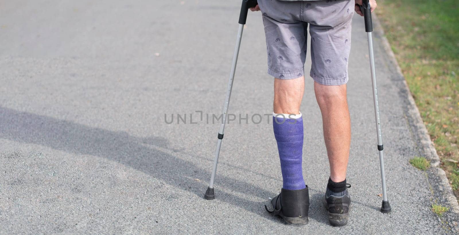 man with a broken leg walks down the street, his left leg is in a cast, the man moves with the help of crutches by KaterinaDalemans